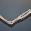 Articulation huméro-ulnaire : anatomie, fonctionnement et pathologies