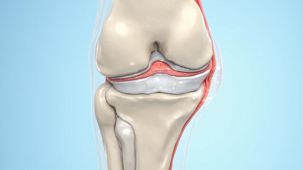Articulation synoviale : anatomie, fonctionnement et pathologies : facteurs de risque