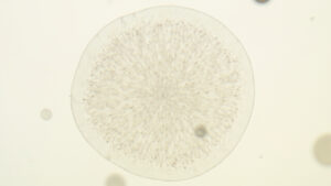 Aspergillus fumigatus : comprendre ce champignon pathogène et ses infections