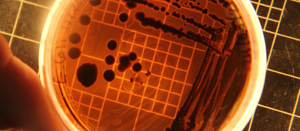 Close-up of bacteria colonies in a petri dish under laboratory conditions.