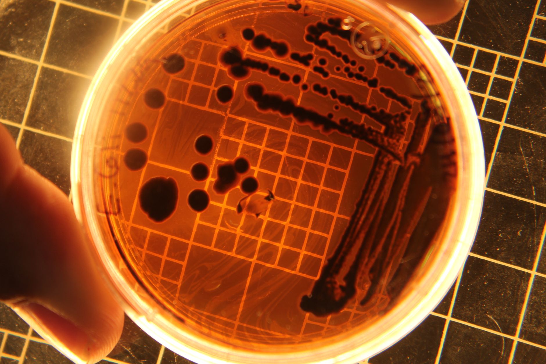 Aspergillus nidulans : tout savoir sur ce champignon opportuniste