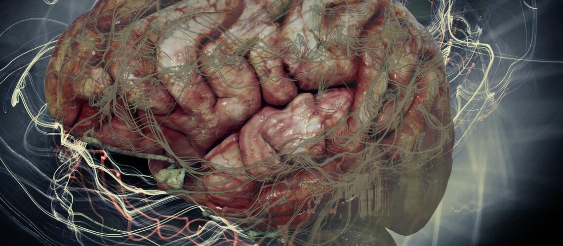 Atrophie multisystématisée : comprendre cette maladie neurodégénérative rare