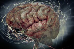 Atrophie multisystématisée : comprendre cette maladie neurodégénérative rare