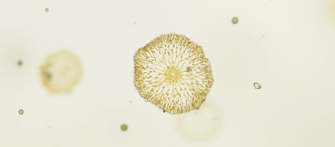 Blastomyces dermatitidis : comprendre cette infection fongique rare