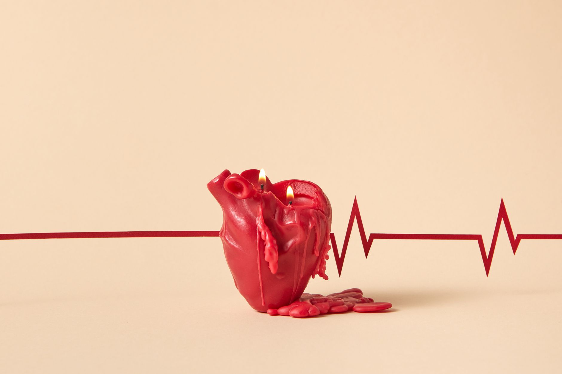 Bloc auriculo-ventriculaire : comprendre, diagnostiquer et traiter ce trouble du rythme cardiaque