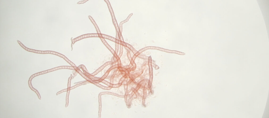 Borrelia afzelii : la bactérie européenne de la borréliose de Lyme