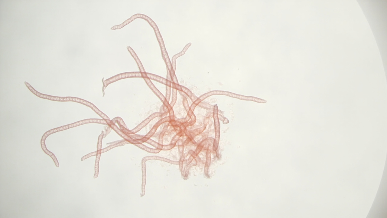Borrelia afzelii : la bactérie européenne de la borréliose de Lyme