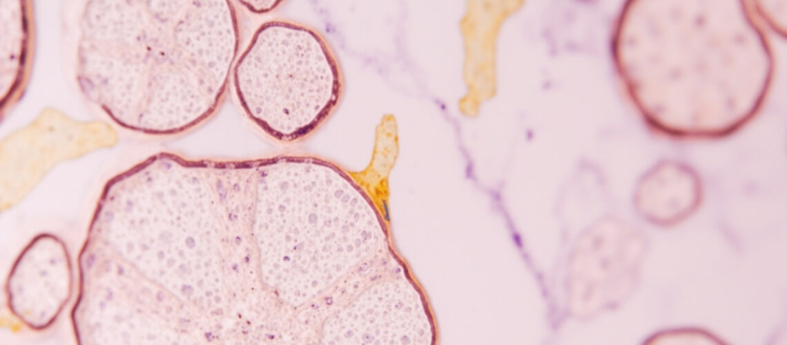 Cellules de Langerhans : rôle essentiel dans l'immunité cutanée