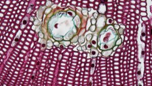Cellules de Leydig : rôle, fonctionnement et importance pour la santé masculine