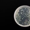 Cellulosimicrobium : caractéristiques, infections et prise en charge médicale