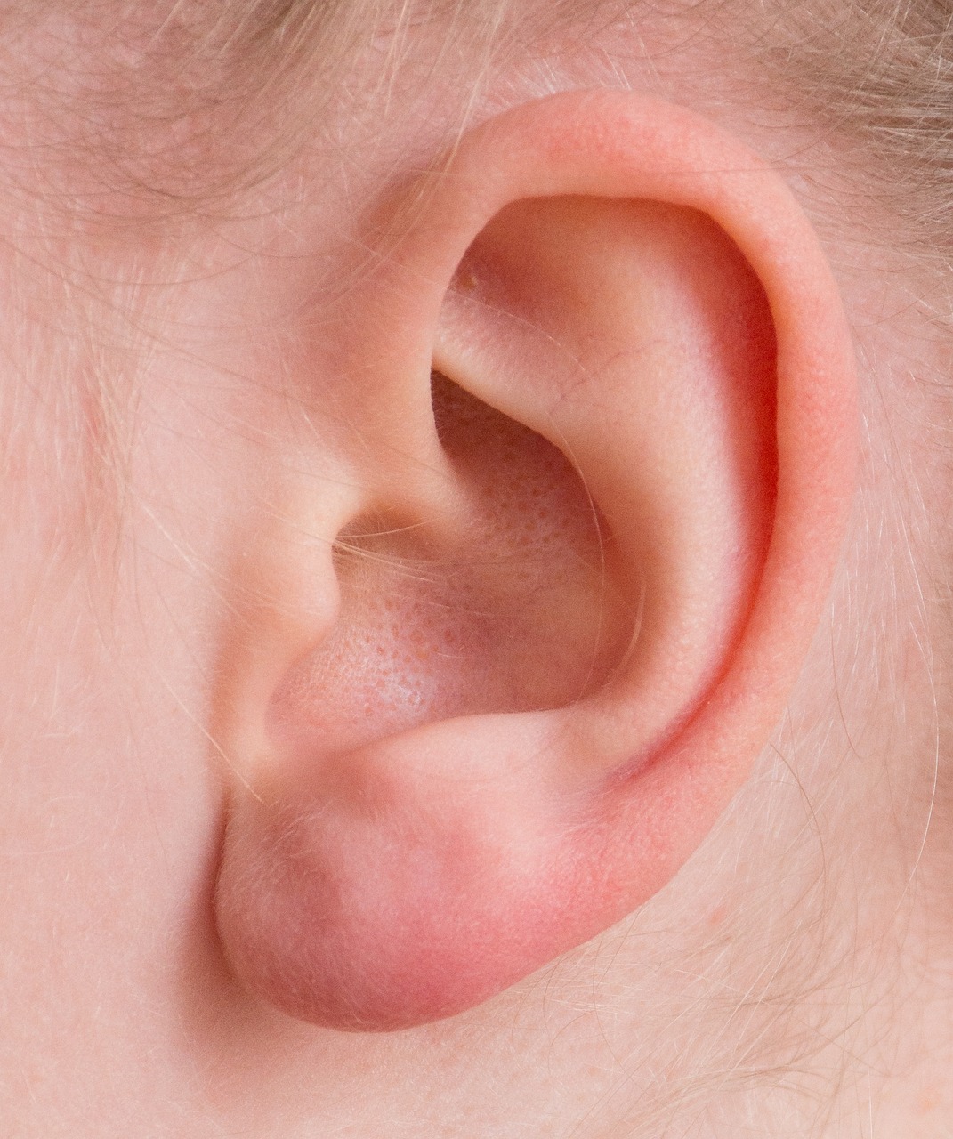 Chondrite auriculaire : causes, symptômes et traitements