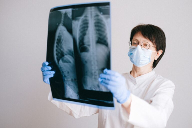 Chylothorax : causes, symptômes, diagnostic et traitement