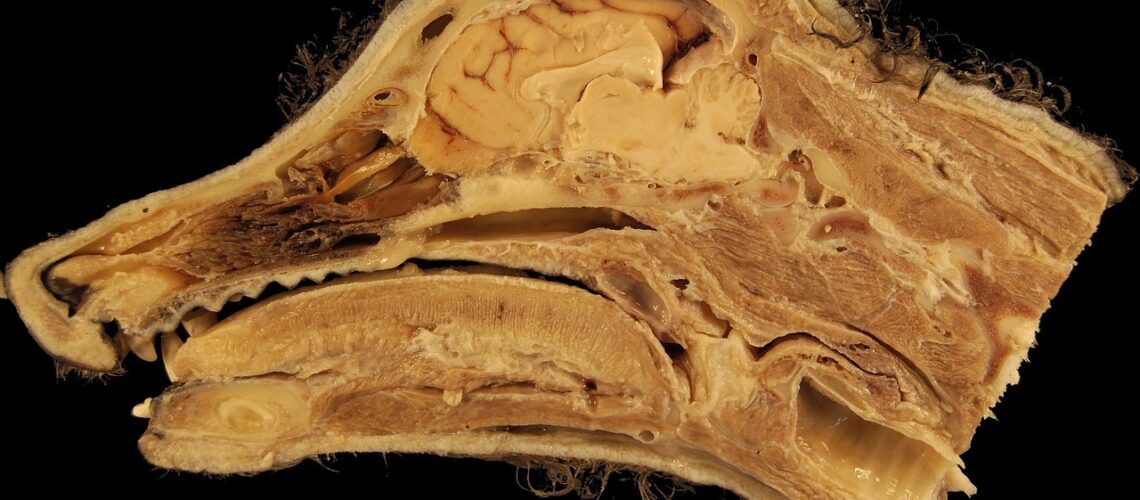 Cloison nasale : anatomie, fonctions et pathologies