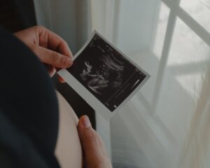 Cordon ombilical nuchal : prévention, détection et gestion