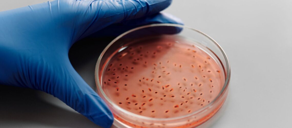 Close-up of a gloved hand holding a bacteria culture in a petri dish for laboratory analysis.