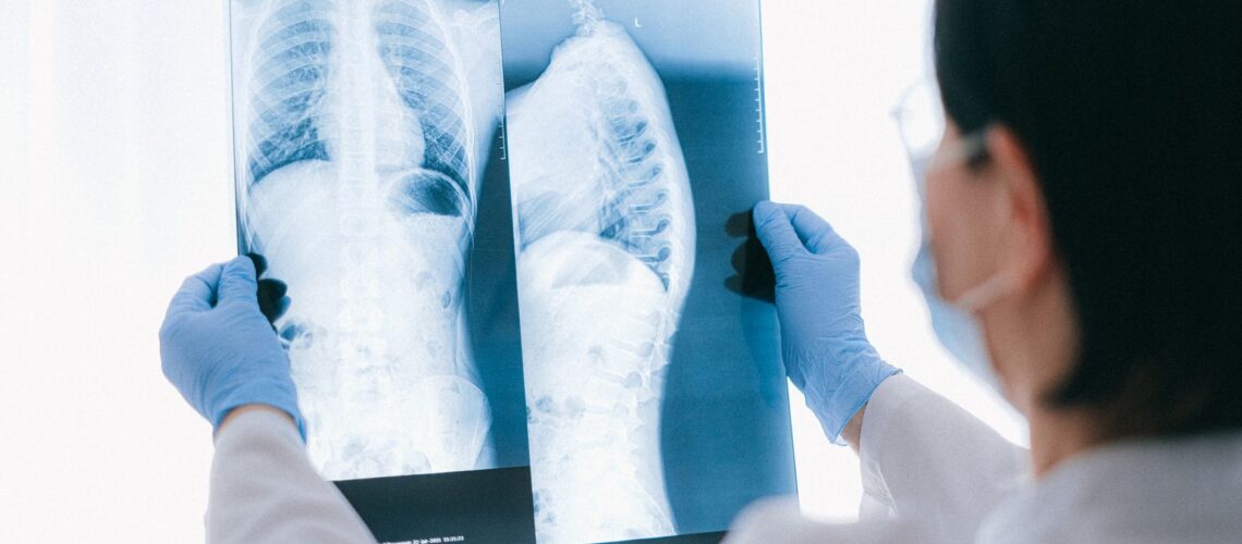 Medical professional analyzing chest x-ray images in a clinical setting for diagnostic purposes.