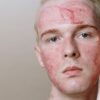 Close-up of a man with red skincare treatment mask, emphasizing healthy skin and self-care.