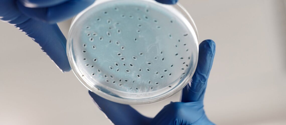 Close-up of gloved hands holding a petri dish with bacterial cultures in a lab.