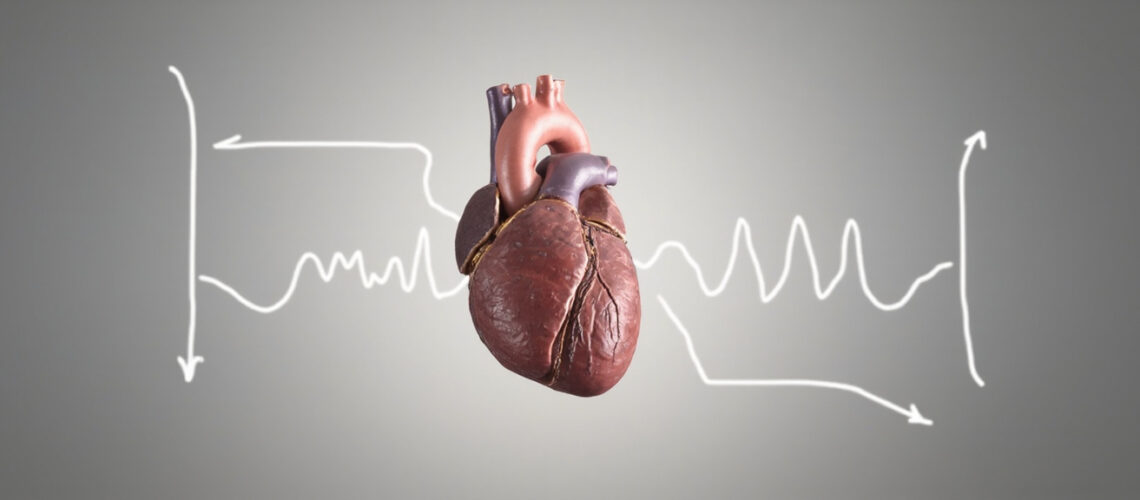 Fibrillation ventriculaire : causes, symptômes et prise en charge d&rsquo;urgence