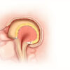 Fistule anale : causes, symptômes, diagnostic et traitements
