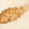 Fonsecaea : comprendre ce champignon responsable de la chromoblastomycose