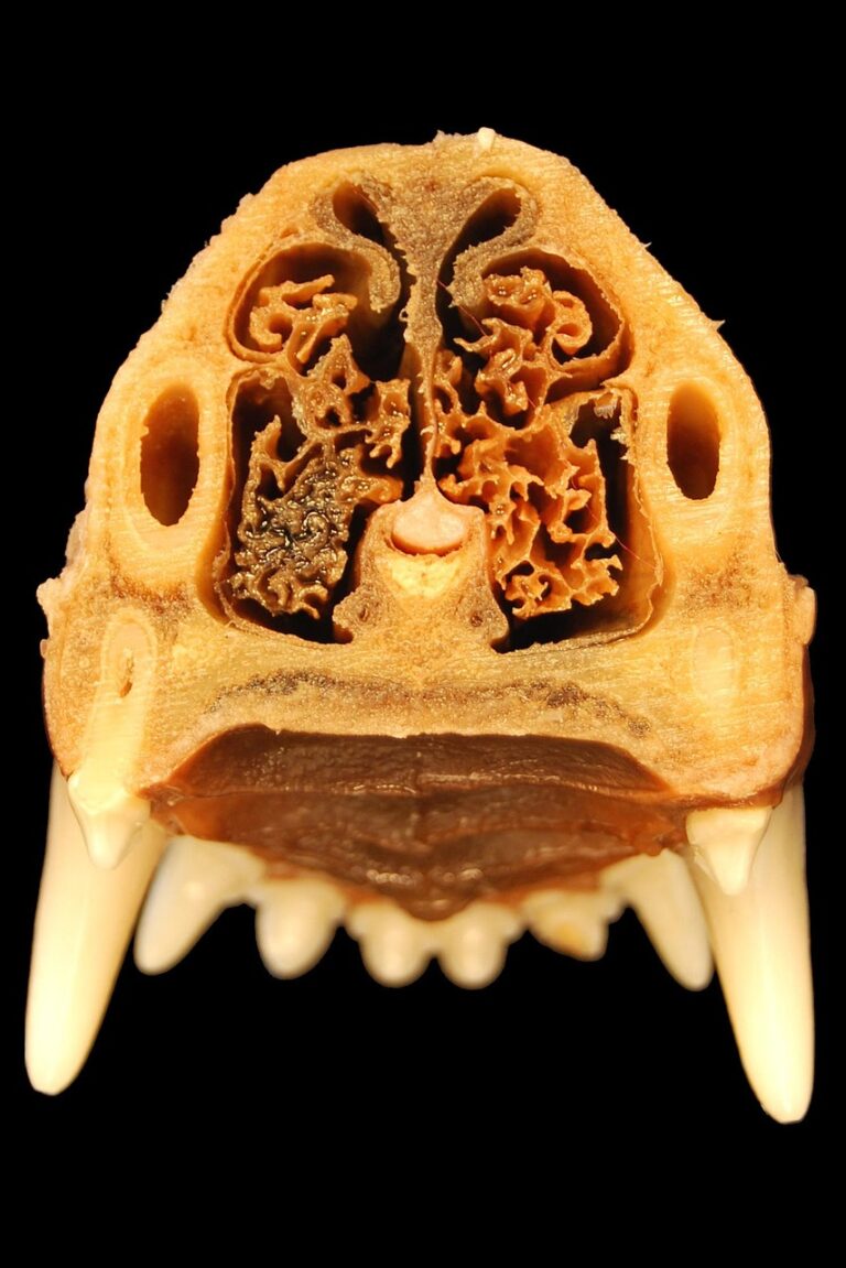 Fosse nasale : anatomie, fonctions et santé de la cavité nasale
