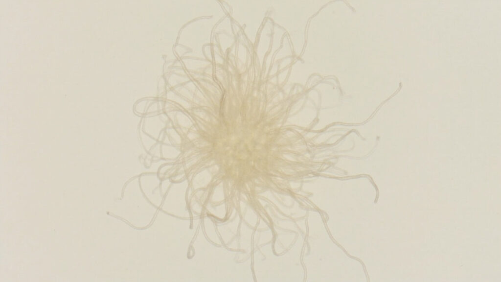 Fusobacterium mortiferum : caractéristiques, infections et traitement : facteurs de risque