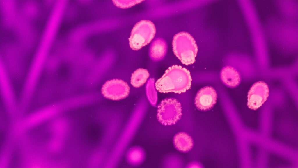 Fusobacterium mortiferum : caractéristiques, infections et traitement : vue générale