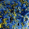 Microscopic view of yellow virus particles on a blue surface, showcasing intricate details.