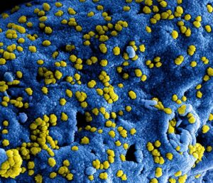 Grippe B Victoria : symptômes, diagnostic, traitement et prévention