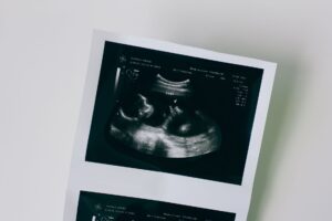 Grossesse gémellaire : tout ce qu'il faut savoir sur une grossesse de jumeaux