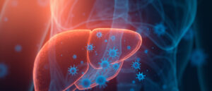 Hépatite C : tout comprendre sur cette infection virale du foie