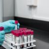 Hypokaliémie : Causes, Symptômes, Traitement et Prévention