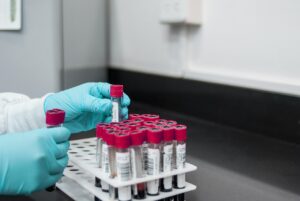 Hypokaliémie : Causes, Symptômes, Traitement et Prévention