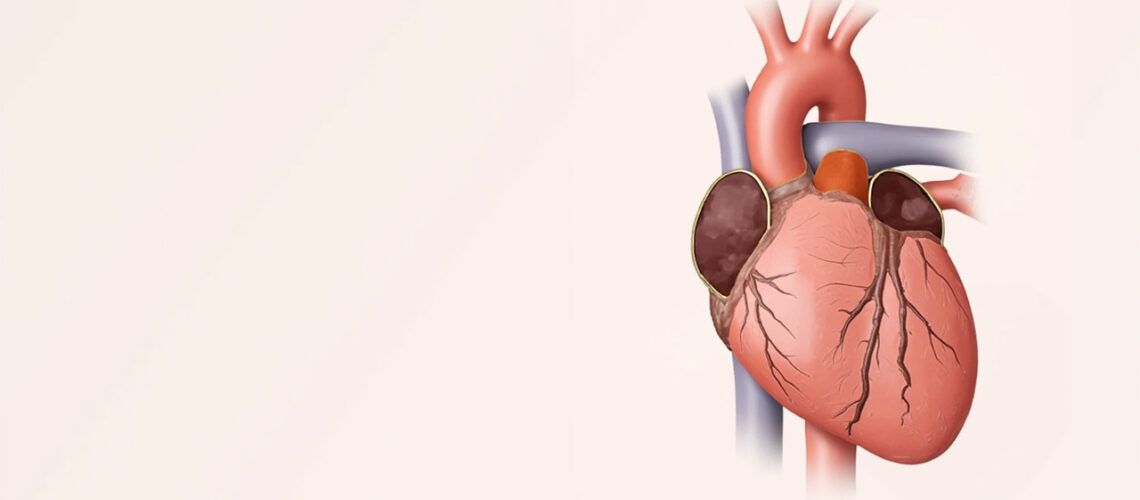 Insuffisance tricuspide : comprendre cette valvulopathie du cœur droit