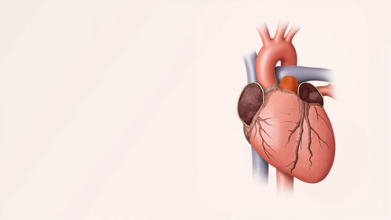 Insuffisance tricuspide : comprendre cette valvulopathie du cœur droit