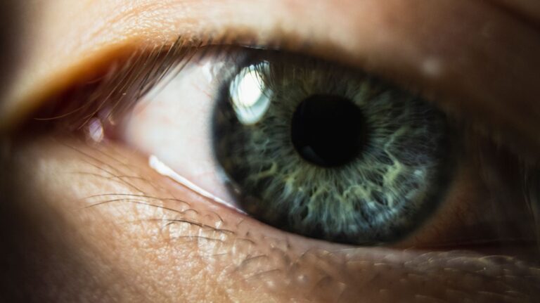 Kératite : causes, symptômes, diagnostic et traitements