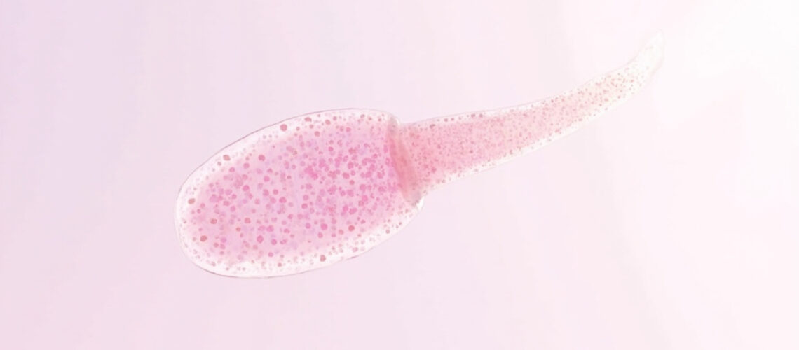 Klebsiella rhinoscleromatis : la bactérie responsable du rhinosclérome