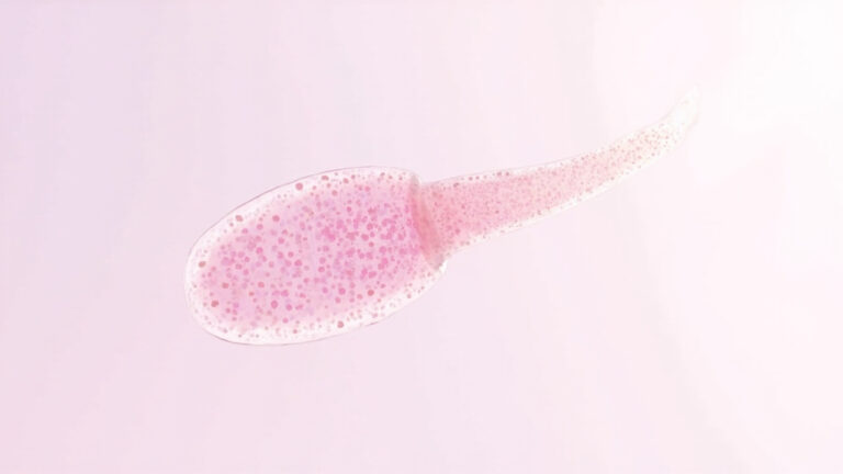 Klebsiella rhinoscleromatis : la bactérie responsable du rhinosclérome