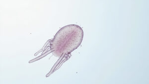 Kocuria : tout savoir sur cette bactérie opportuniste