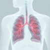 La pneumonie à pneumocoque : causes, symptômes, traitement et prévention
