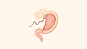 La Téniase : Comprendre, Dépister et Traiter cette Parasitose Intestinale