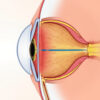 La zonule ciliaire : anatomie, fonctions et pathologies associées