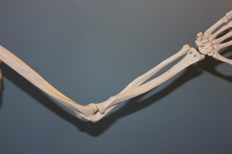 L&rsquo;articulation huméro-radiale : anatomie, fonction et pathologies courantes