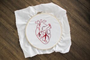 L'auricule droit : anatomie, fonction et pathologies