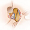 Le canal de Volkmann : structure, fonction et importance dans l'anatomie osseuse