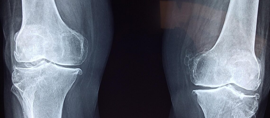 Le Chondrocyte : cellule clé du cartilage et de la santé articulaire