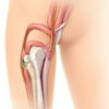 Le ligament ilio-fémoral : anatomie, fonctions et pathologies