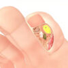 Le lit de l'ongle : anatomie, fonctions et pathologies courantes