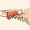 Le muscle épineux : anatomie, fonctions et pathologies associées